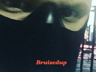 Bruisedup