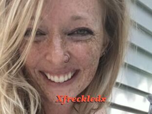 Xfreckledx